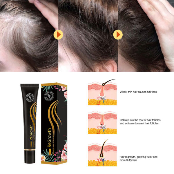 Regrowth Organic Hair Serum Roller Set Hair Care Anti Stripping Liquid Suitable For All Types Of Hair Loss Scalp Nourishing - Image 5